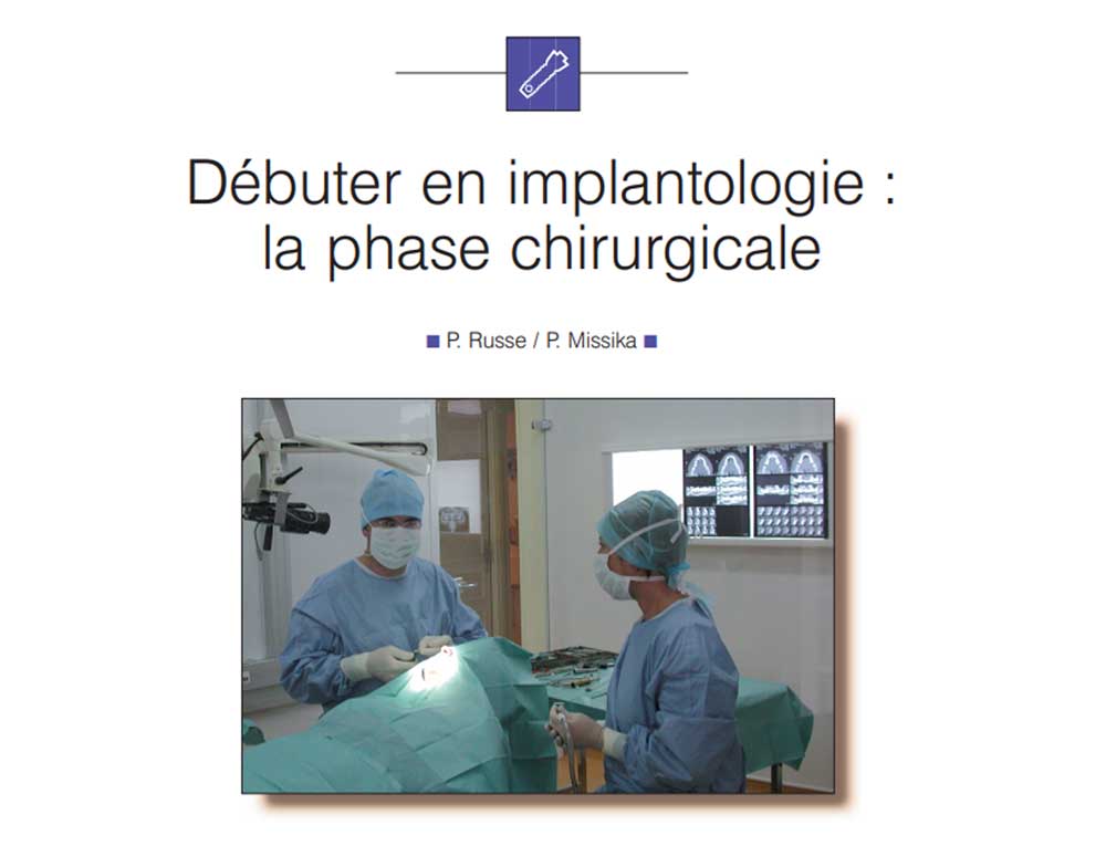 Debuter en implantologie