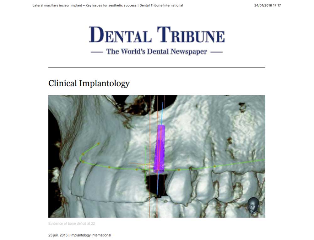 Lire la suite à propos de l’article dental tribune-lateral1